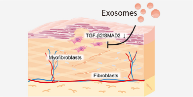 Exosome
